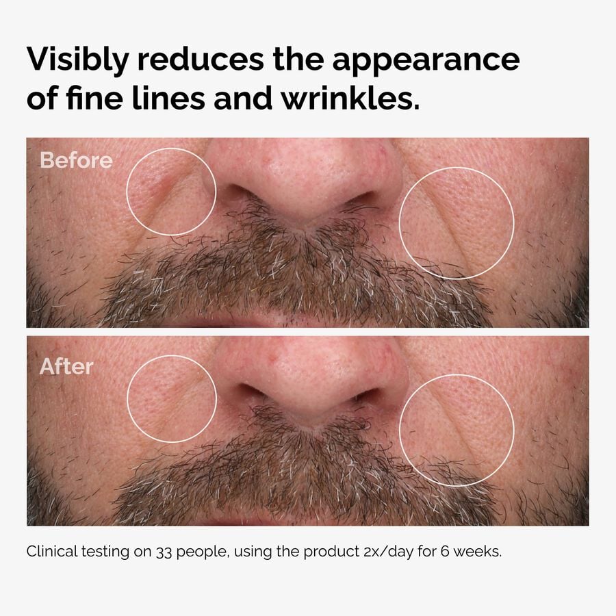 100-fermented-rose-hip-seed-oil-n1 100pct-fermented-rose-hip-before-after-wrinkles.jpg