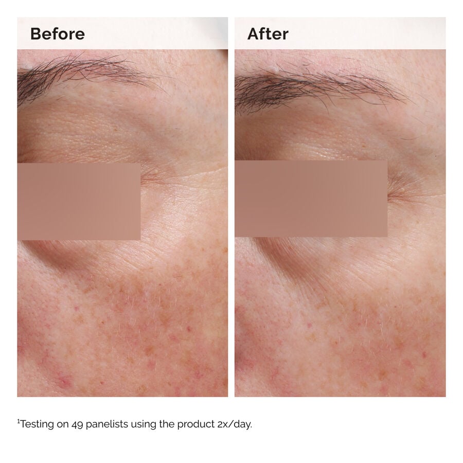 niacinamide-5-face-and-body-emulsion-b8 2024-08-23-ORD-Nia-5pct-Face-Body-B-A-Elasticity-Global-02-1x1.jpg