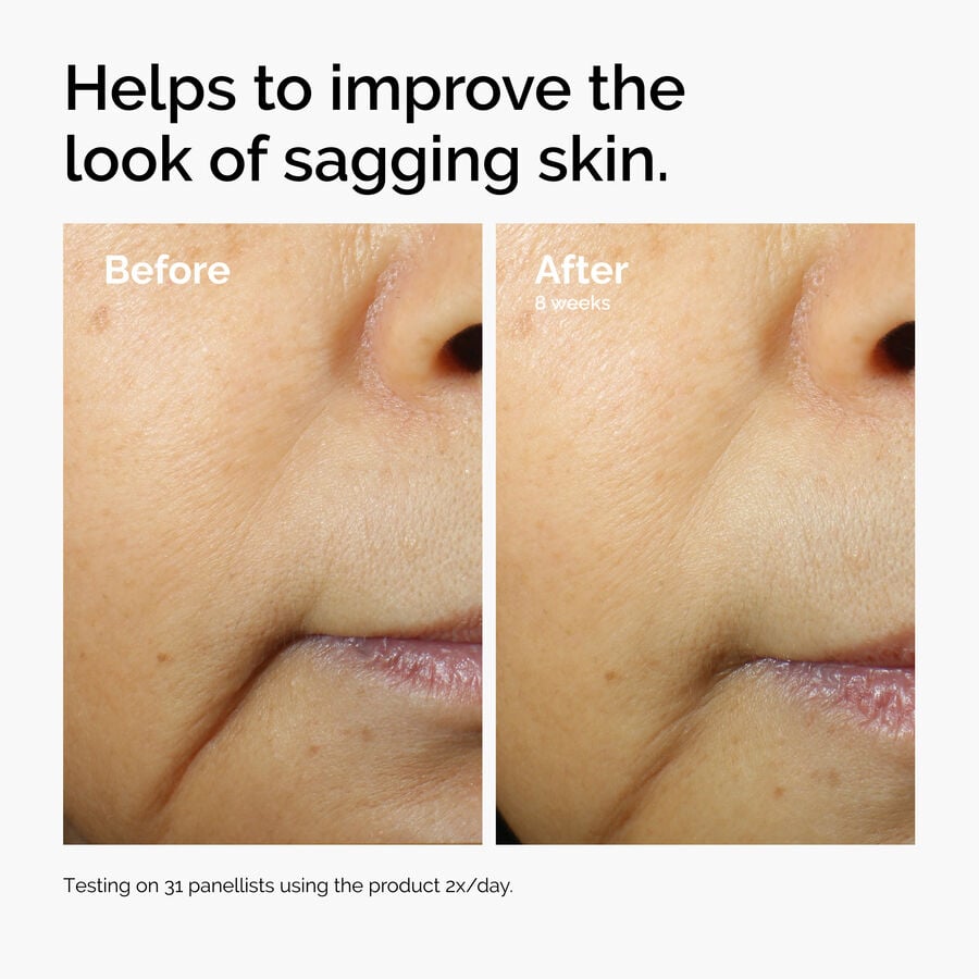 caffeine-3-escin-1-face-serum-d6 ord-caffeine-3pct-escin-1pct-face-serum-before-after-sagging.jpg