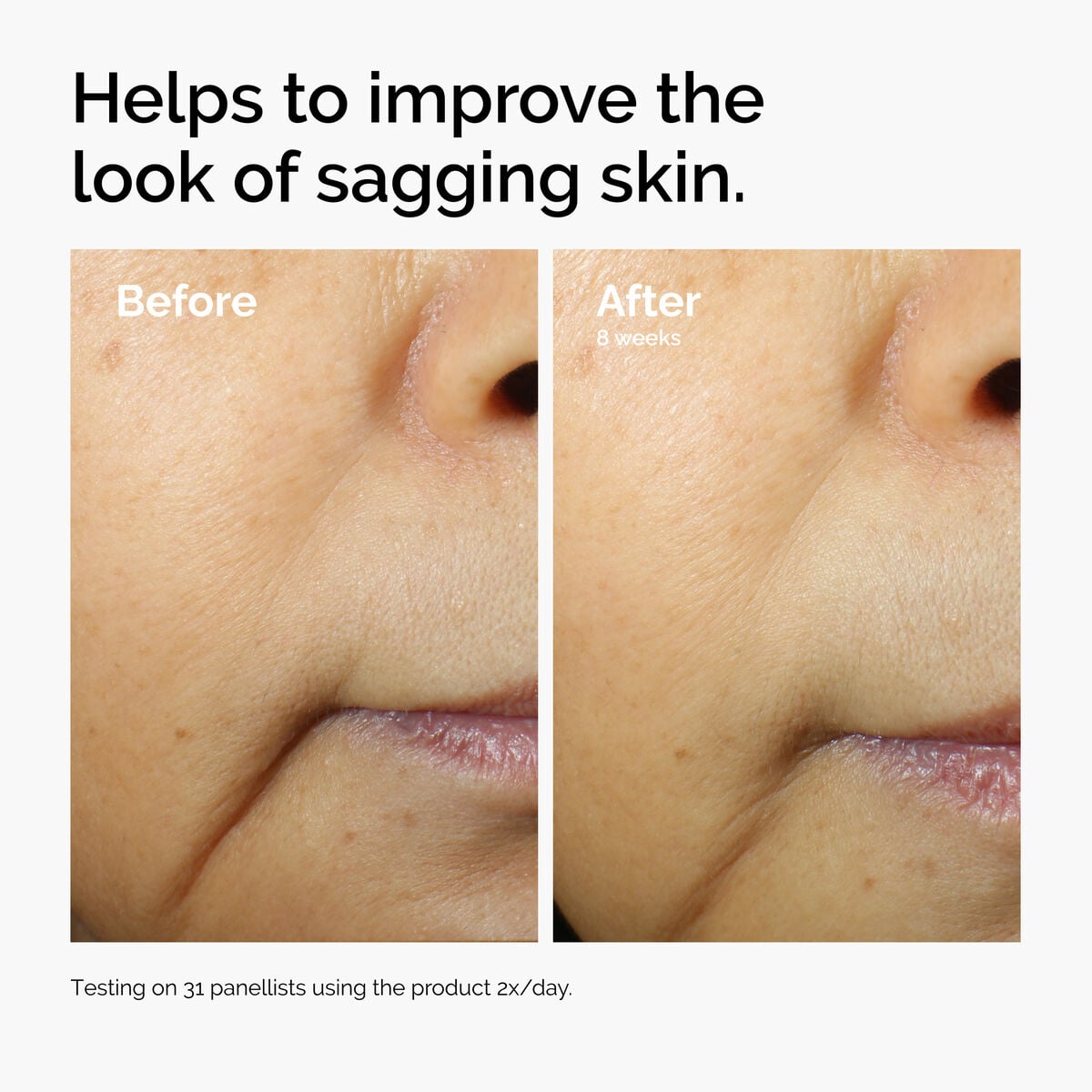 caffeine-3-escin-1-face-serum-d6 ord-caffeine-3pct-escin-1pct-face-serum-before-after-sagging.jpg