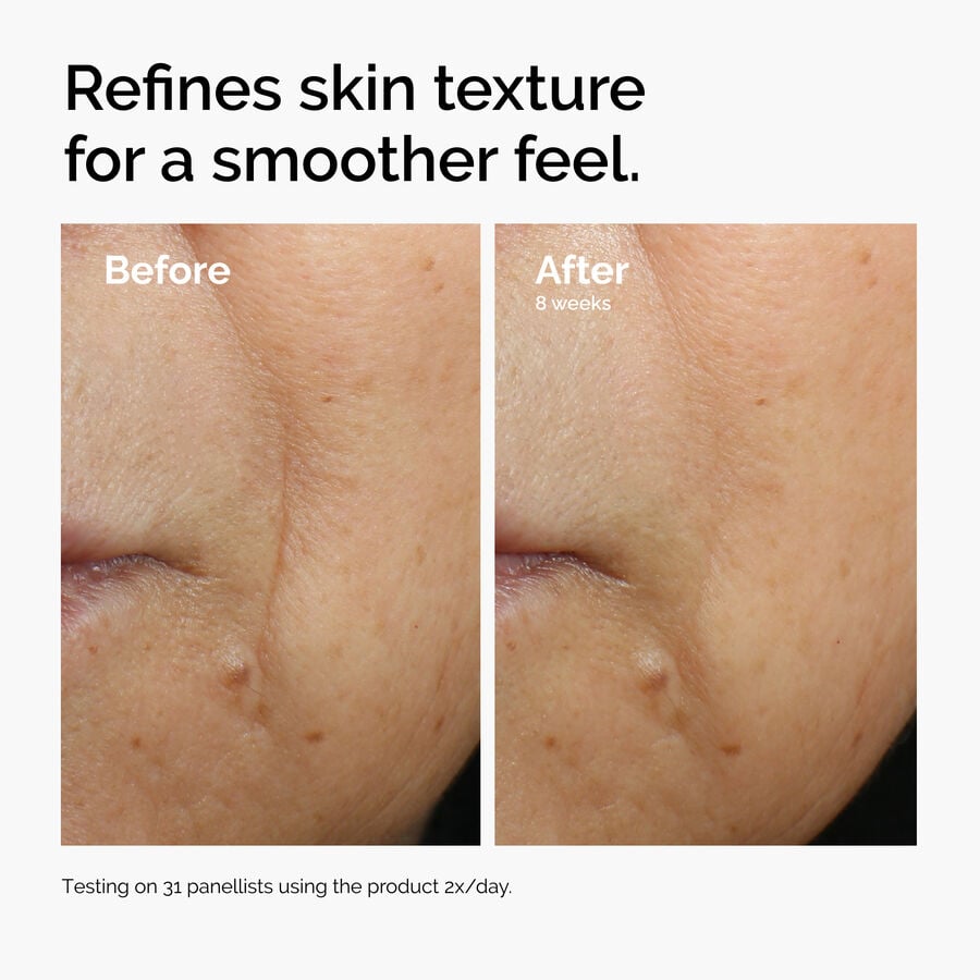 caffeine-3-escin-1-face-serum-d6 ord-caffeine-3pct-escin-1pct-face-serum-before-after-texture.jpg