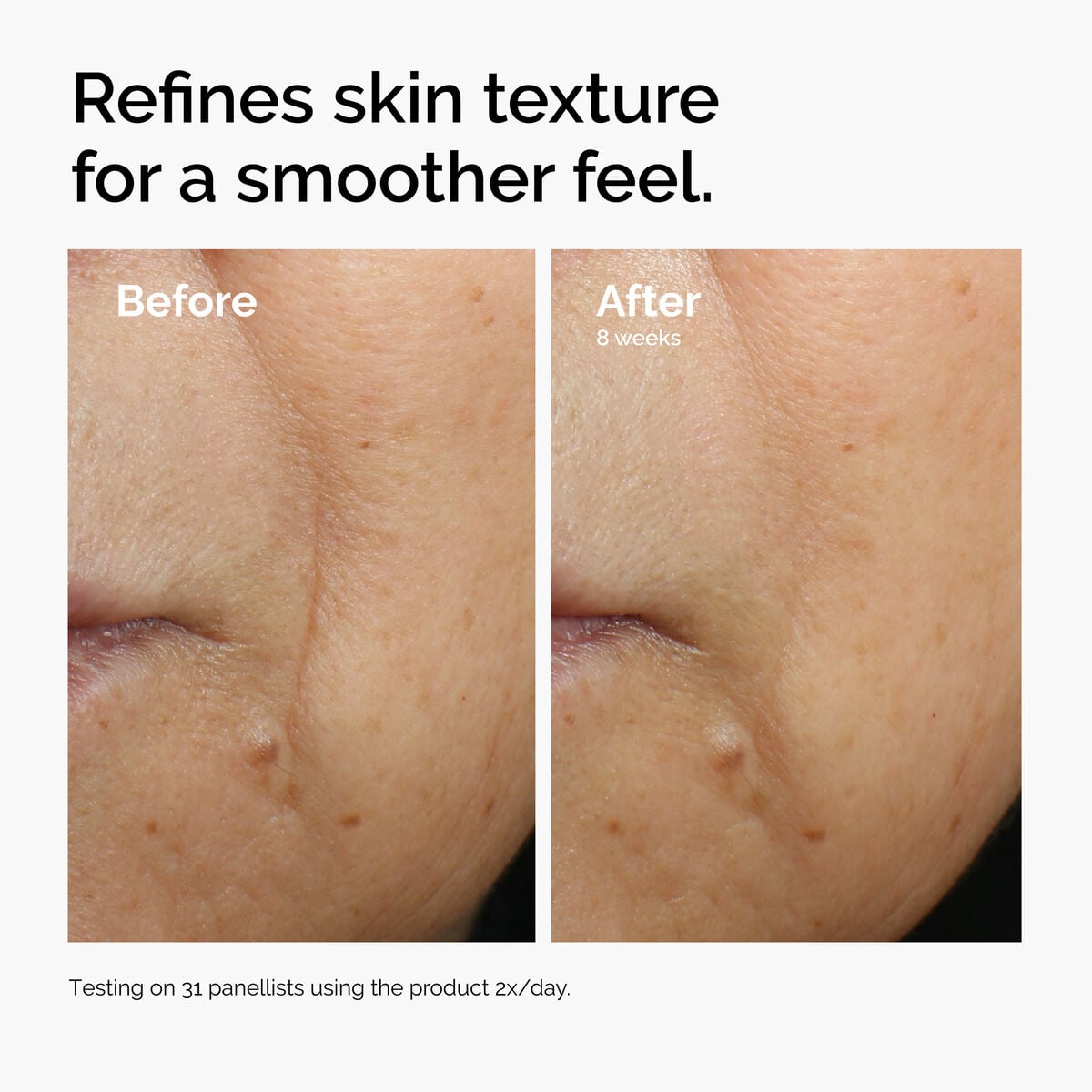 caffeine-3-escin-1-face-serum-d6 ord-caffeine-3pct-escin-1pct-face-serum-before-after-texture.jpg