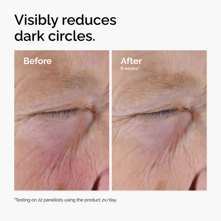 caffeine-solution-5-egcg-eye-serum-b2 ord-caffeine-solution-egcg-dark-circles-before-after.jpg
