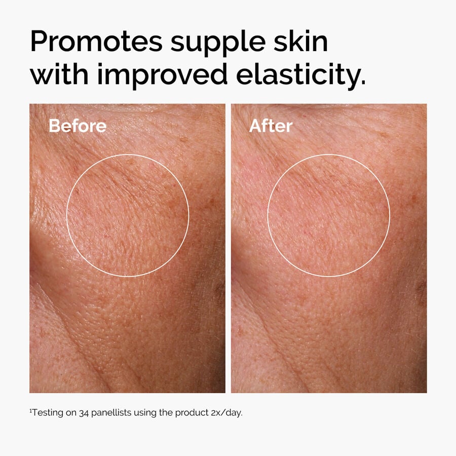 hyaluronic-acid-2-b5-with-ceramides-i4 ord-hyaluronic-acid-2pct-b5-hydrating-serum-before-after-elasticity.jpg