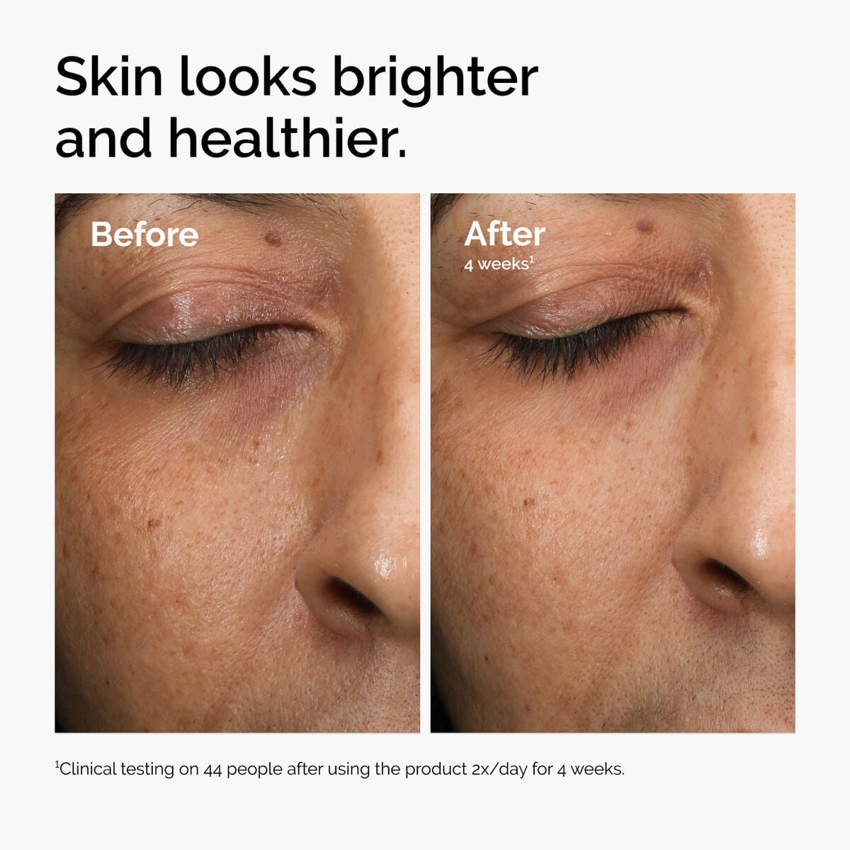 multi-antioxidant-radiance-serum-e5 ord-mars-before-after-healthy.jpg