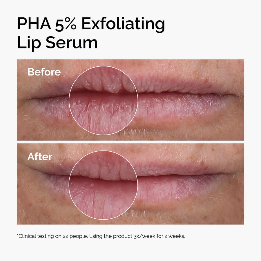 pha-5-exfoliating-lip-serum-p6 ord-pha-5pct-lip-exfoliating-serum-before-after.jpg